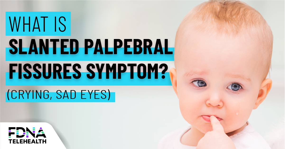 Down slanting palpebral fissures overview & causes