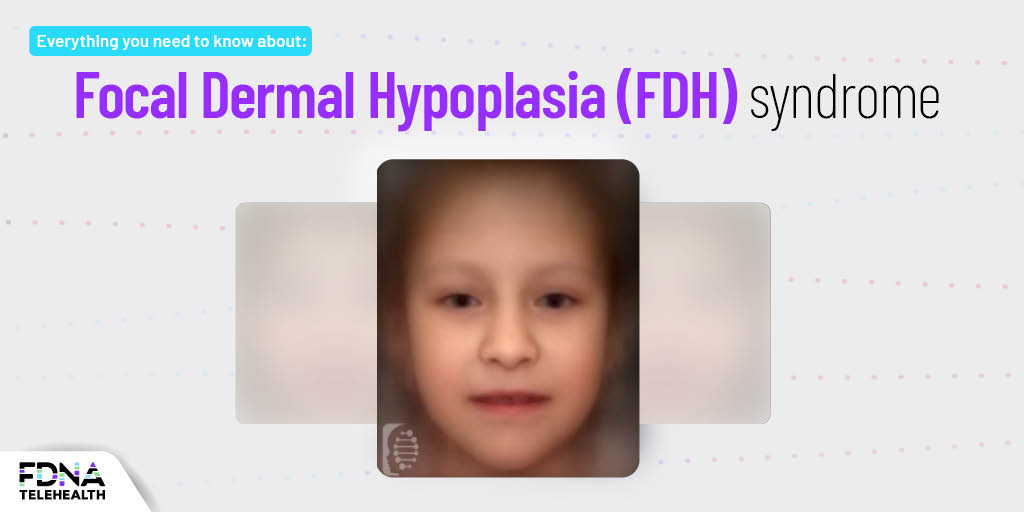 Seizures causes, and link with rare disease symptoms