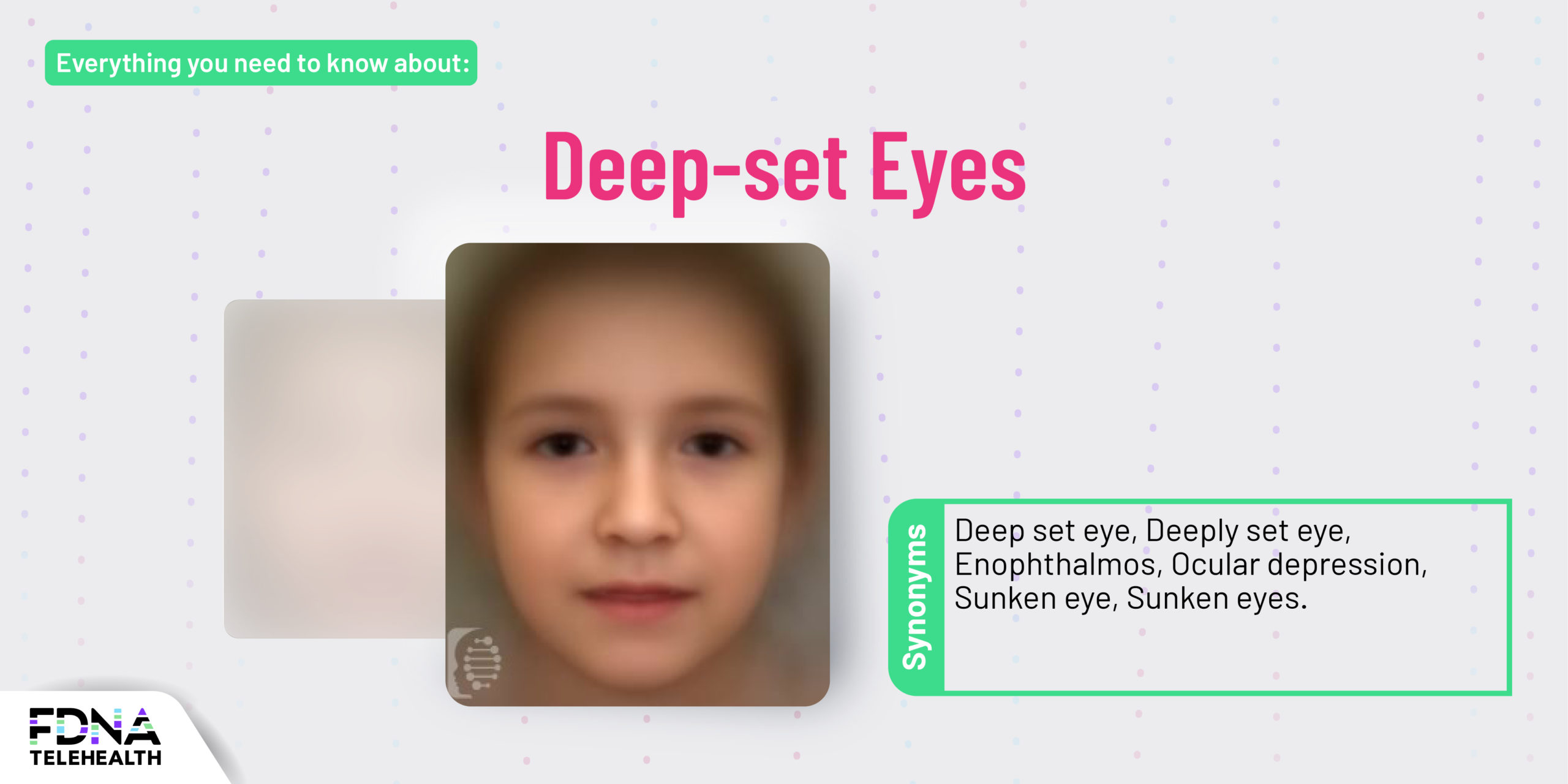 deep-set-eyes-meaning