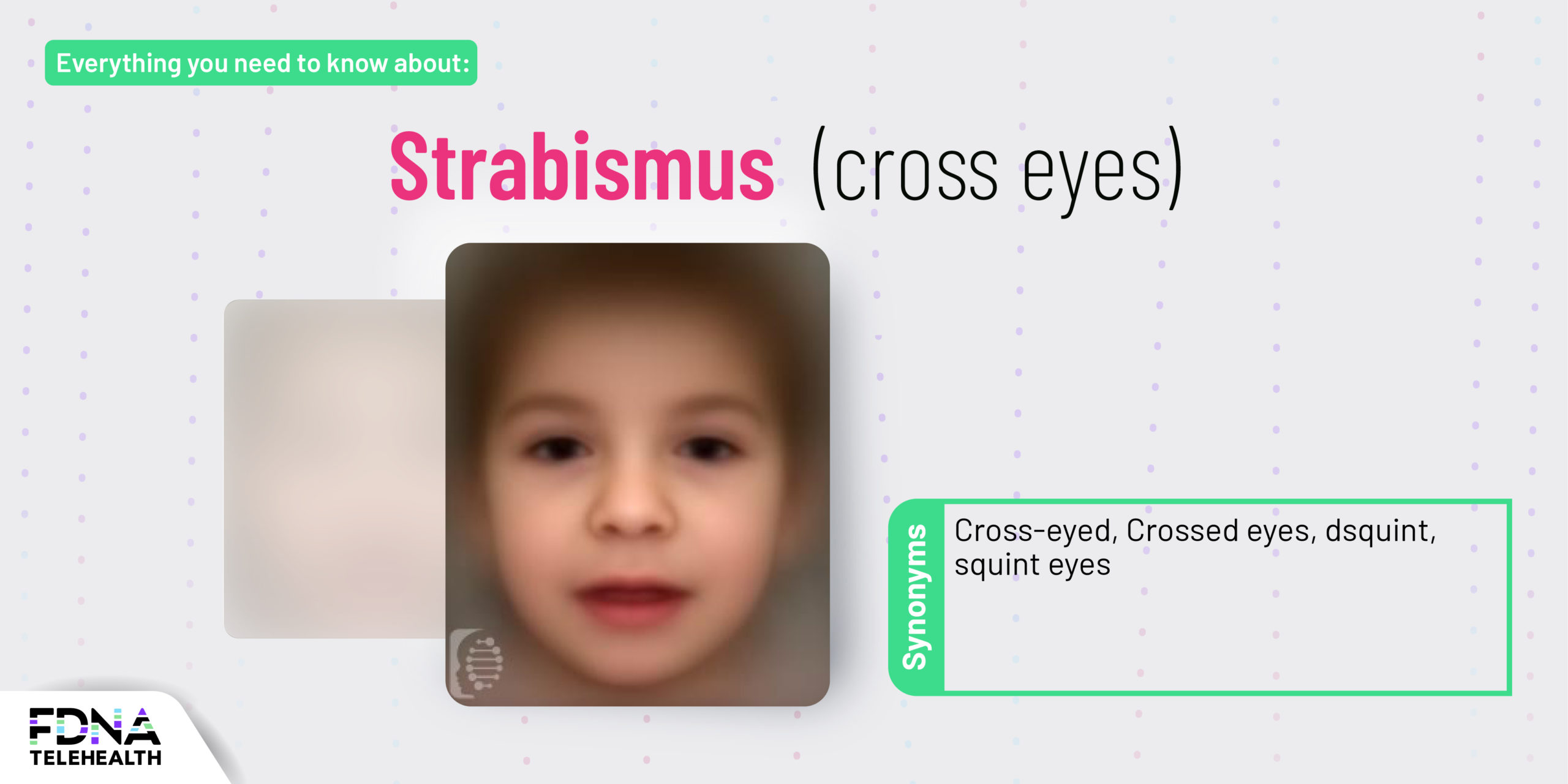 What Causes Strabismus or Crossed Eyes?