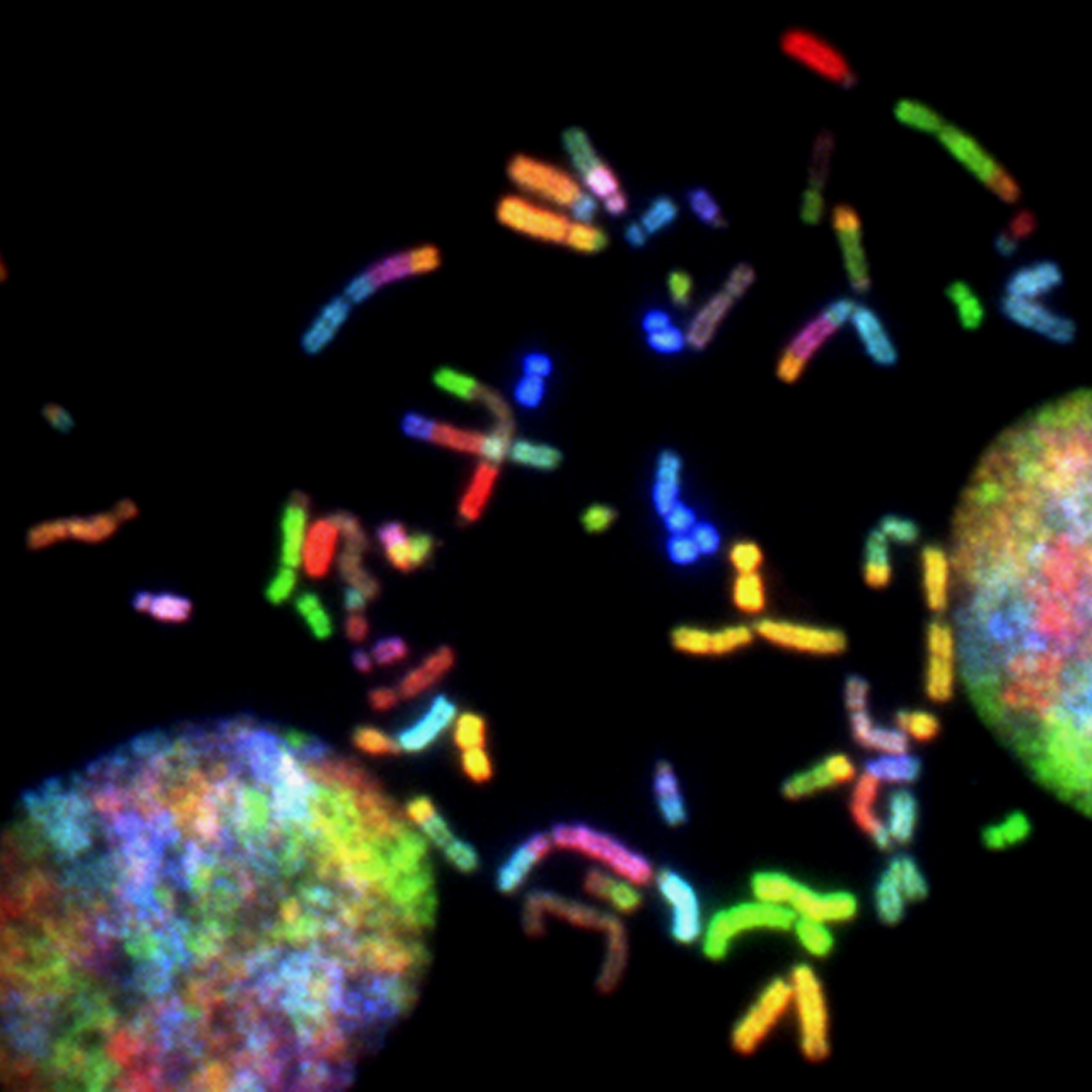 chromosomal microarray